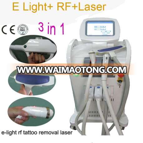 Multifunctional IPL RF Laser ND YAG Tattoo Removal Machine