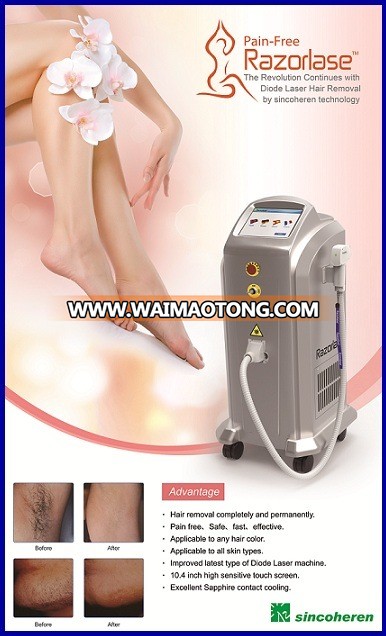 Hair Removal Machine Permanent 808nm Diode Laser Machine Beauty Equipment